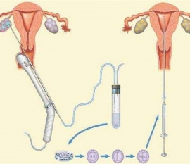 35岁女性备孕请做好以下检查，“健康保定代生宝宝”跑不远